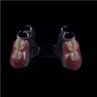 이동식 아크릴 부분 틀니